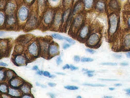 IHC of Cytokeratin HMW/AE3 on a FFPE Salivary Gland Tissue